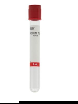 Tubos de extracción de sangre, lisos (tapón rojo)